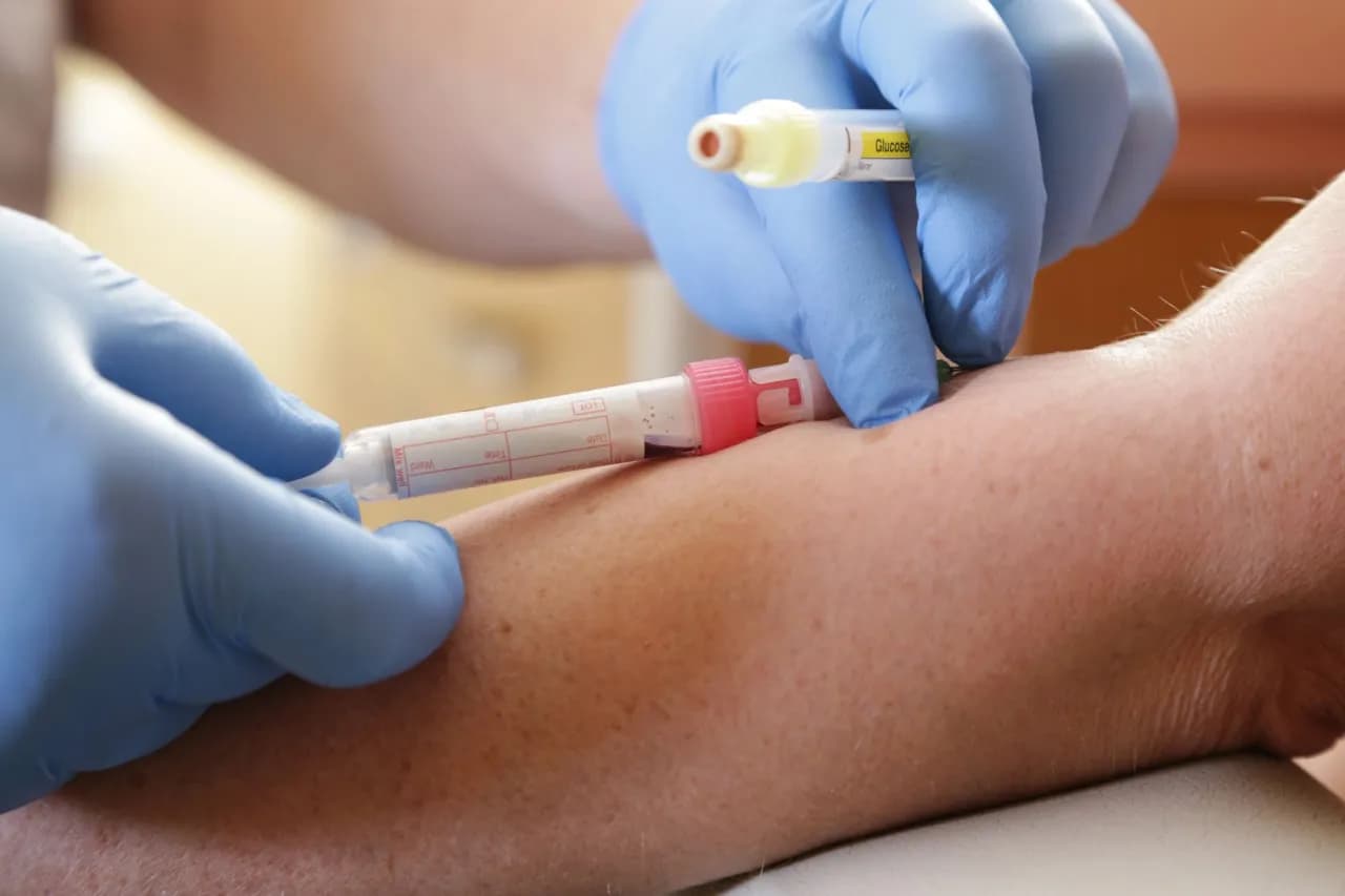 Czy na badanie krwi trzeba być na czczo? Ważne informacje, które musisz znać Czy na badanie krwi trzeba być na czczo? Ważne informacje, które musisz znać