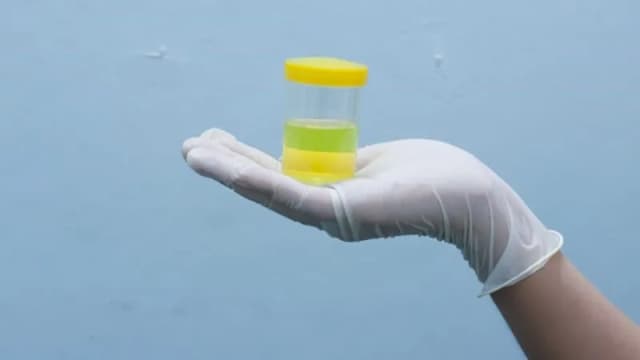 Ile moczu do badania dziecka? Kluczowe informacje dla rodziców Ile moczu do badania dziecka? Kluczowe informacje dla rodziców