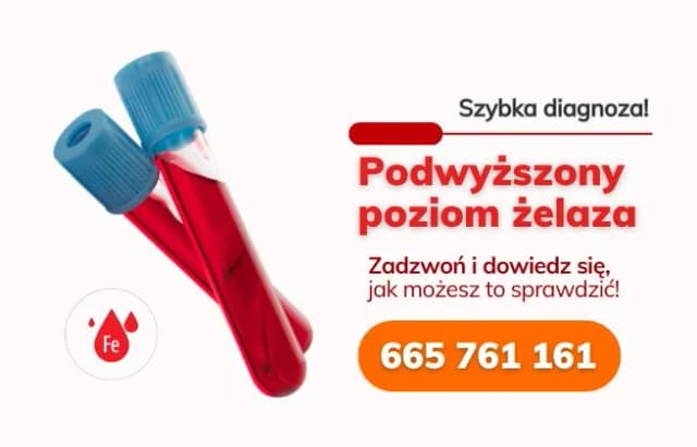 Jak obniżyć podwyższony poziom żelaza? Skuteczne metody i porady dla zdrowia Jak obniżyć podwyższony poziom żelaza? Skuteczne metody i porady dla zdrowia