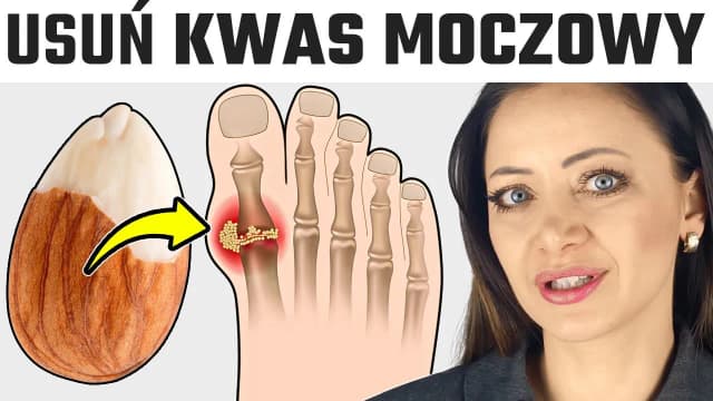 Jakie leki na kwas moczowy skutecznie obniżą jego poziom i złagodzą ból? Jakie leki na kwas moczowy skutecznie obniżą jego poziom i złagodzą ból?