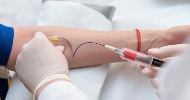 Podwyższony poziom hemoglobiny: przyczyny, objawy i skutki zdrowotne Podwyższony poziom hemoglobiny: przyczyny, objawy i skutki zdrowotne