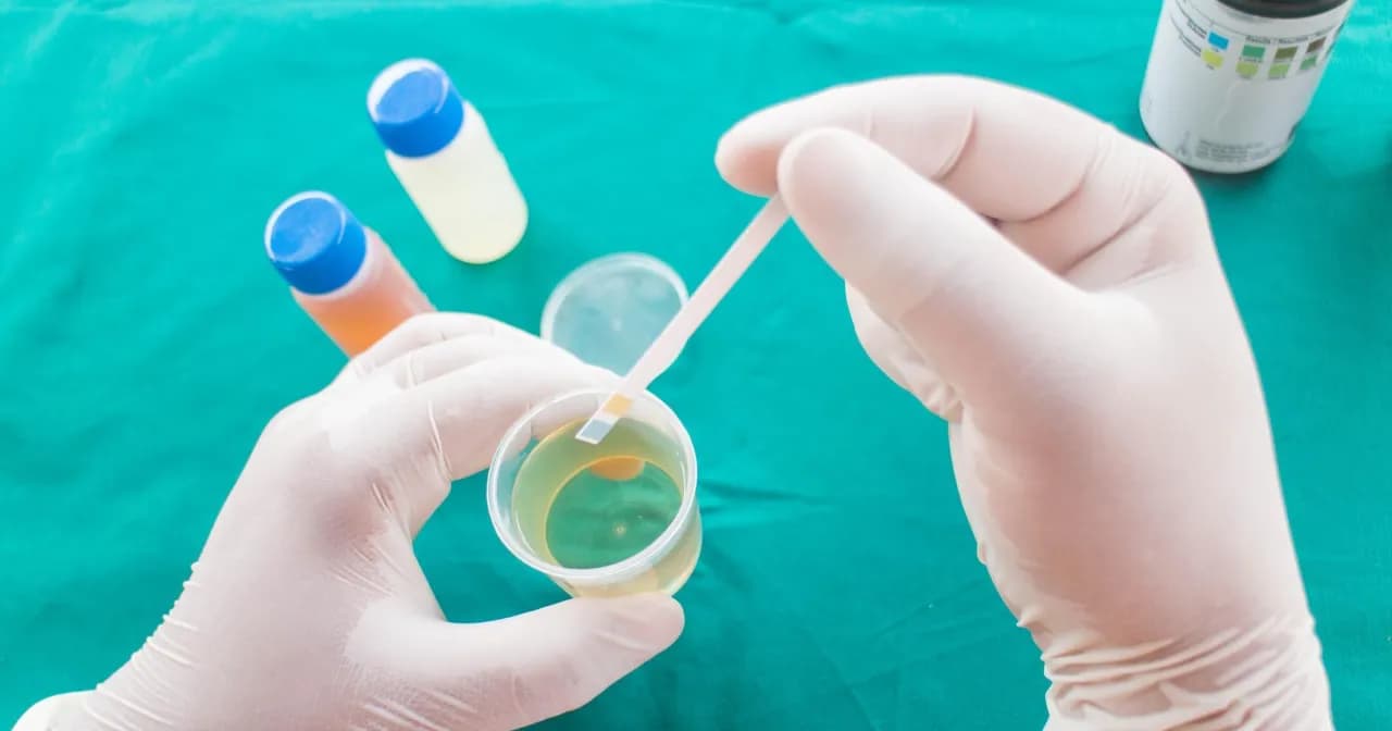 Ile moczu wystarczy do badania? Sprawdź, by uniknąć błędów Ile moczu wystarczy do badania? Sprawdź, by uniknąć błędów