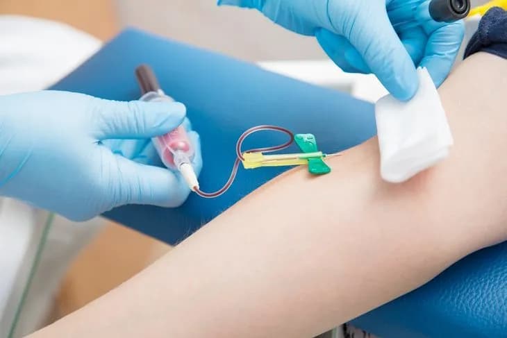 Podwyższony poziom androstendionu: przyczyny, objawy i diagnostyka Podwyższony poziom androstendionu: przyczyny, objawy i diagnostyka