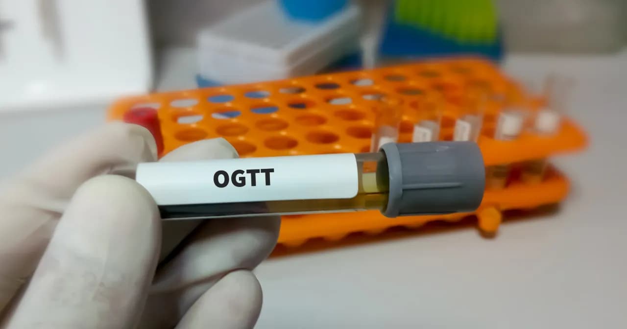 Co można jeść przed badaniem glukozy, aby wyniki były wiarygodne? Co można jeść przed badaniem glukozy, aby wyniki były wiarygodne?