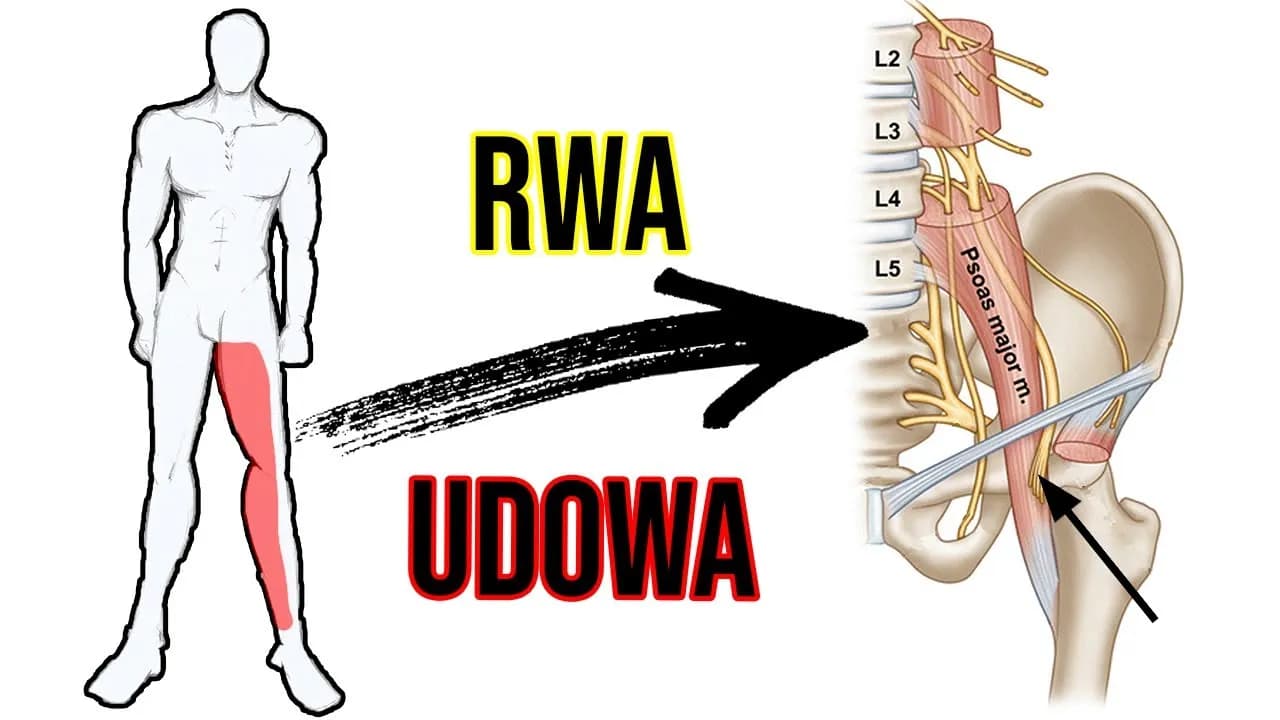 Jakie leki na rwę udową mogą skutecznie złagodzić Twój ból? Jakie leki na rwę udową mogą skutecznie złagodzić Twój ból?