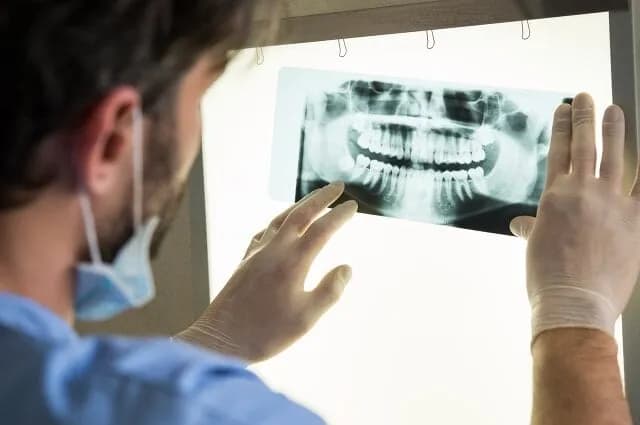 Dentysta NFZ co obejmuje? Sprawdź, jakie zabiegi są dostępne Dentysta NFZ co obejmuje? Sprawdź, jakie zabiegi są dostępne