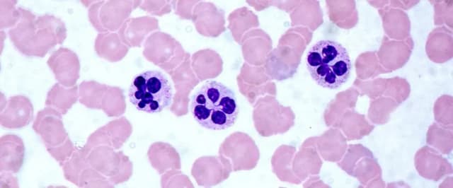 Podwyższony poziom leukocytów we krwi – co to oznacza i jakie są przyczyny? Podwyższony poziom leukocytów we krwi – co to oznacza i jakie są przyczyny?